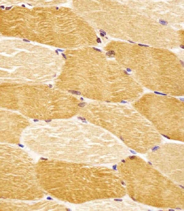 m04718 anti slc29a2 antibody n term ihc p testing 2