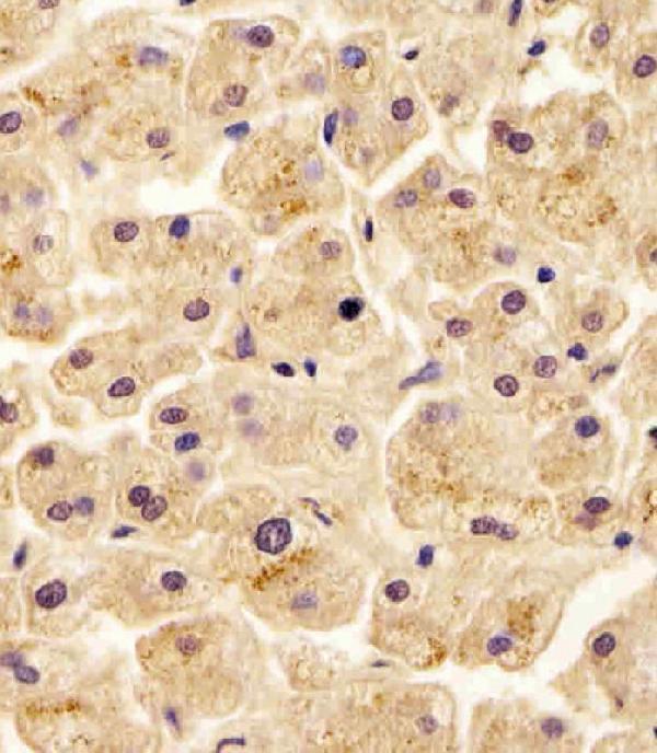 m04718 anti slc29a2 antibody n term ihc p testing 3
