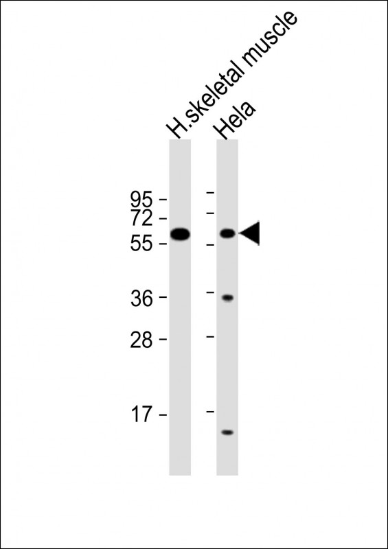 m04718 anti slc29a2 antibody n term wb testing 1