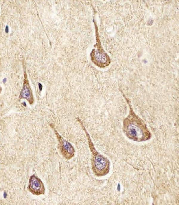 m04721 anti npy2r antibody n term ihc testing 3