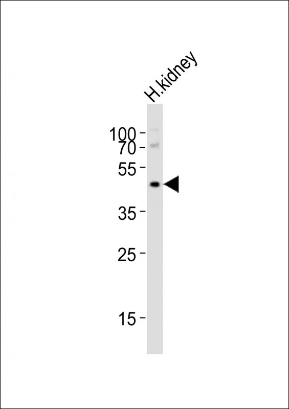 m04721 anti npy2r antibody n term wb testing 2