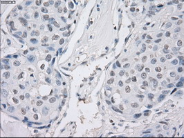 m04723 1 anti pp5 ppp5c mouse monoclonal antibody clone id oti4g8 ihc testing 10