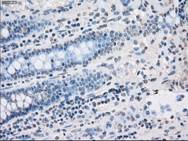 m04723 1 anti pp5 ppp5c mouse monoclonal antibody clone id oti4g8 ihc testing 12