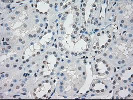 m04723 1 anti pp5 ppp5c mouse monoclonal antibody clone id oti4g8 ihc testing 13