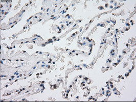 m04723 1 anti pp5 ppp5c mouse monoclonal antibody clone id oti4g8 ihc testing 14