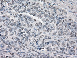 m04723 1 anti pp5 ppp5c mouse monoclonal antibody clone id oti4g8 ihc testing 3