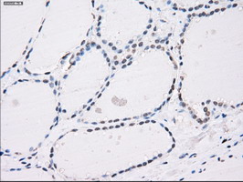 m04723 1 anti pp5 ppp5c mouse monoclonal antibody clone id oti4g8 ihc testing 5