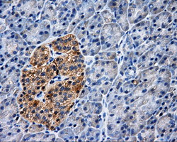 m04726 anti pask mouse monoclonal antibody clone id oti8g9 ihc testing 2