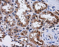 m04726 anti pask mouse monoclonal antibody clone id oti8g9 ihc testing 3