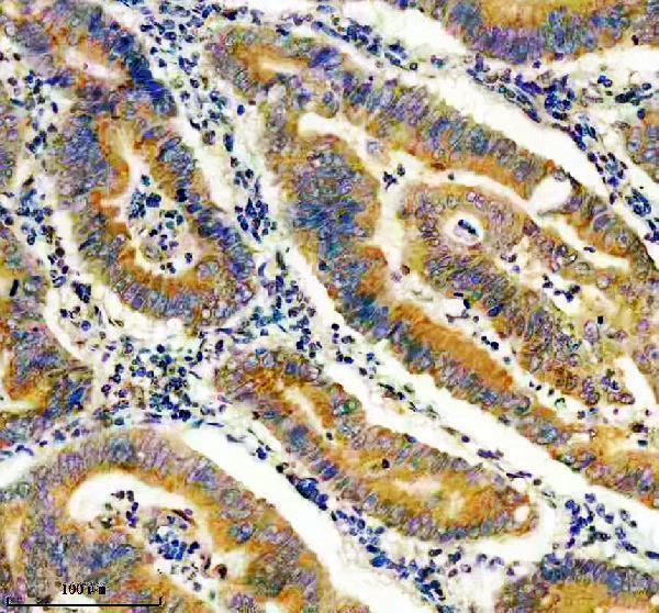 IHC analysis of UBE2D1 using anti-UBE2D1 antibody (M04728-1)