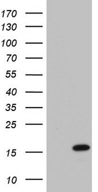 HEK293T cells were transfected with the pCMV6-ENTRY control (Left lane) or pCMV6-ENTRY UBE2D1 (Right lane) cDNA for 48 hrs and lysed