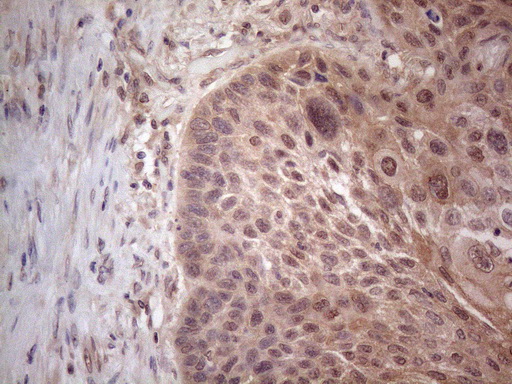 m04733 anti mtf1 mouse monoclonal antibody clone id oti2f3 ihc testing 2