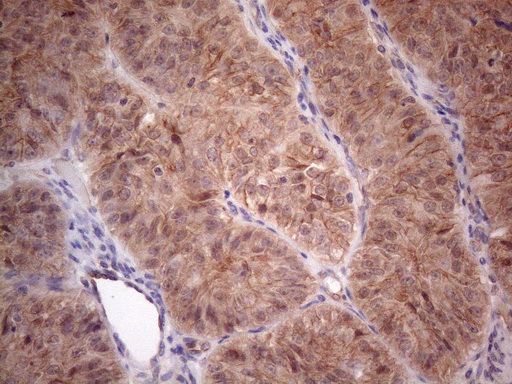 m04733 anti mtf1 mouse monoclonal antibody clone id oti2f3 ihc testing 4