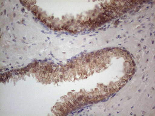m04733 anti mtf1 mouse monoclonal antibody clone id oti2f3 ihc testing 5