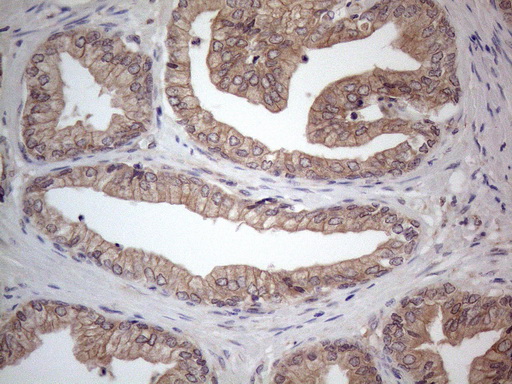 m04733 anti mtf1 mouse monoclonal antibody clone id oti2f3 ihc testing 6