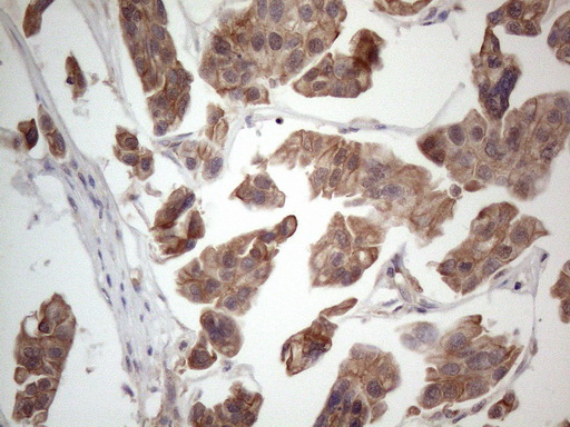 m04733 anti mtf1 mouse monoclonal antibody clone id oti2f3 ihc testing 7