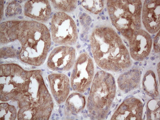 m04733 anti mtf1 mouse monoclonal antibody clone id oti2f3 ihc testing 8