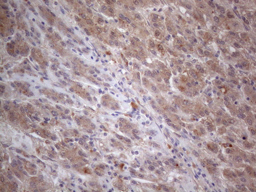 m04733 anti mtf1 mouse monoclonal antibody clone id oti2f3 ihc testing 9