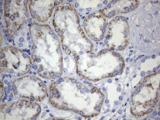 m04735 anti tem1 cd248 mouse monoclonal antibody clone id oti1h6 ihc testing 2