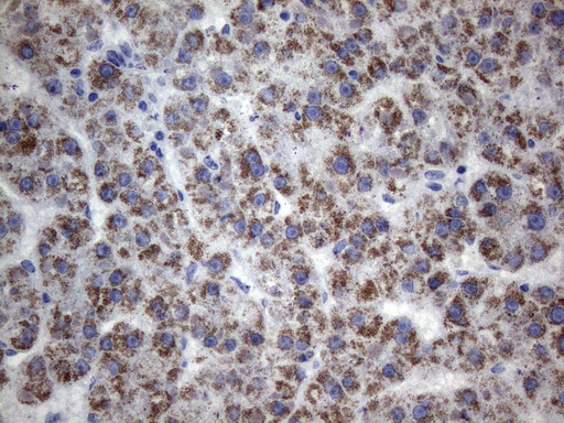 m04735 anti tem1 cd248 mouse monoclonal antibody clone id oti1h6 ihc testing 3