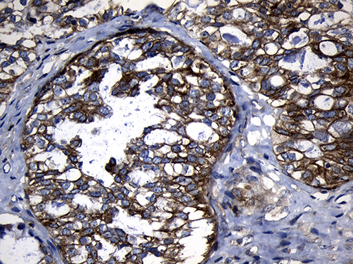 m04737 anti calcium binding protein p22 chp1 mouse monoclonal antibody clone id oti4b9 ihc testing 2