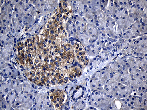 m04737 anti calcium binding protein p22 chp1 mouse monoclonal antibody clone id oti4b9 ihc testing 3