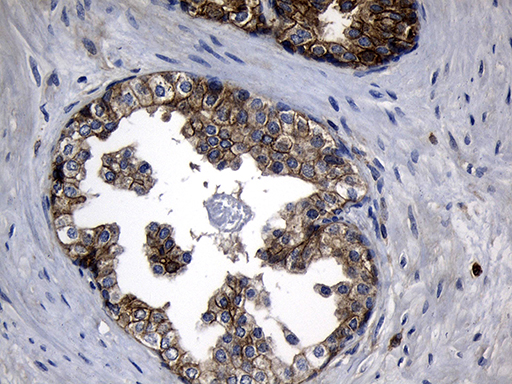 m04737 anti calcium binding protein p22 chp1 mouse monoclonal antibody clone id oti4b9 ihc testing 4