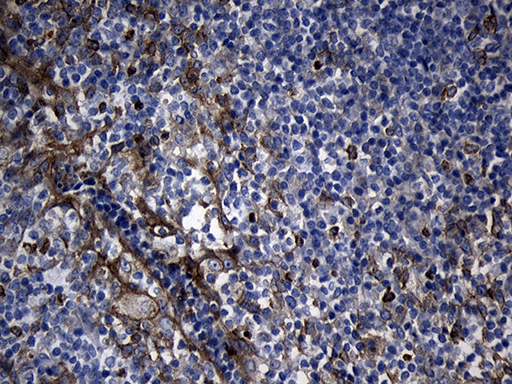 m04737 anti calcium binding protein p22 chp1 mouse monoclonal antibody clone id oti4b9 ihc testing 5