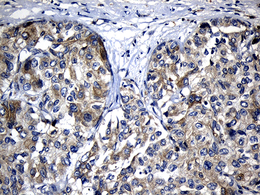m04737 anti calcium binding protein p22 chp1 mouse monoclonal antibody clone id oti4b9 ihc testing 6