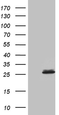 m04737 anti calcium binding protein p22 chp1 mouse monoclonal antibody clone id oti4b9 wb testing 1
