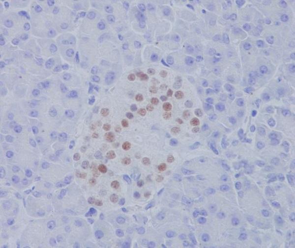 Immunohistochemical analysis of paraffin-embedded human pancreas, using NKX2