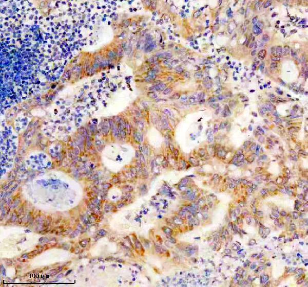 IHC analysis of SLC25A12 using anti-SLC25A12 antibody (M04746)