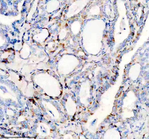 IHC analysis of SLC25A12 using anti-SLC25A12 antibody (M04746)