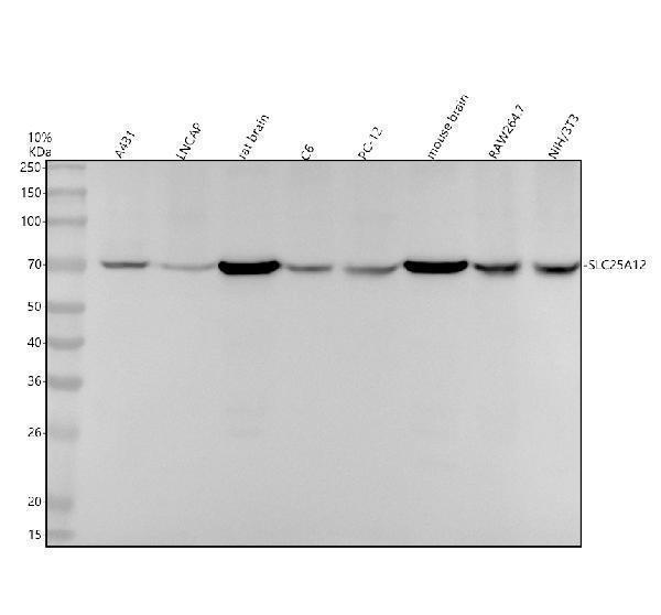 Western blot analysis of SLC25A12 using anti-SLC25A12 antibody (M04746)