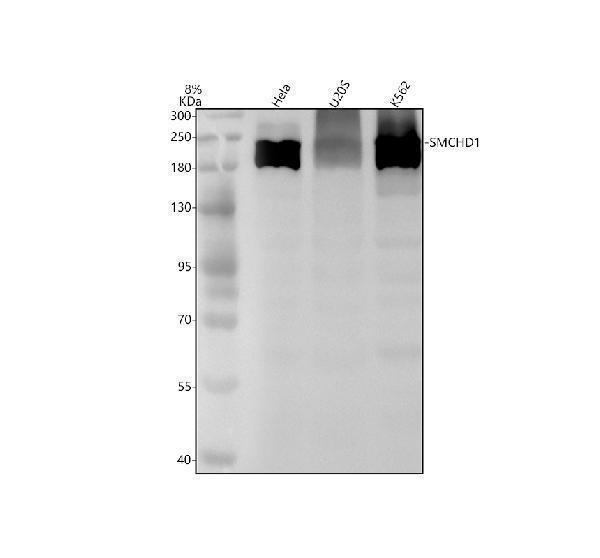 Western blot analysis of SMCHD1 using anti-SMCHD1 antibody (M04751)