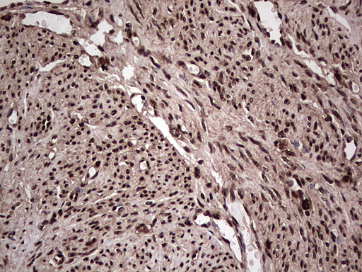 m04753 1 anti sae1 mouse monoclonal antibody clone id oti6b11 ihc testing 10