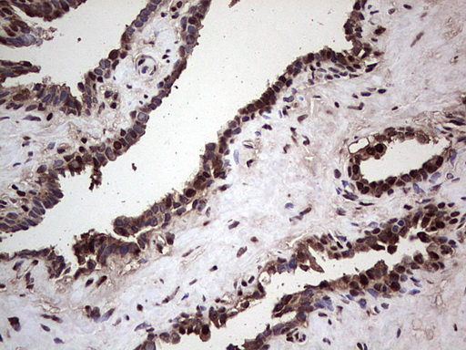 m04753 1 anti sae1 mouse monoclonal antibody clone id oti6b11 ihc testing 11