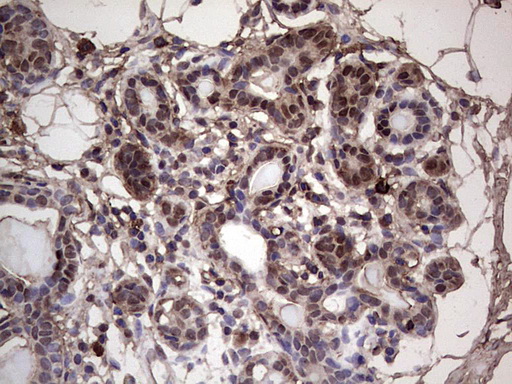 m04753 1 anti sae1 mouse monoclonal antibody clone id oti6b11 ihc testing 12
