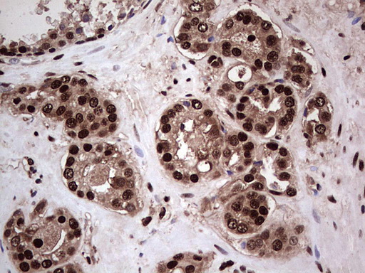 m04753 1 anti sae1 mouse monoclonal antibody clone id oti6b11 ihc testing 13