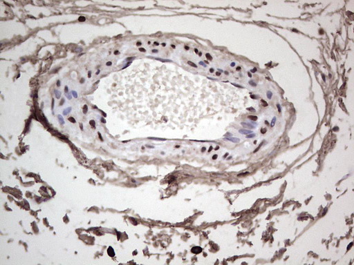 m04753 1 anti sae1 mouse monoclonal antibody clone id oti6b11 ihc testing 14