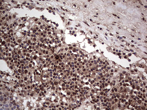 m04753 1 anti sae1 mouse monoclonal antibody clone id oti6b11 ihc testing 15