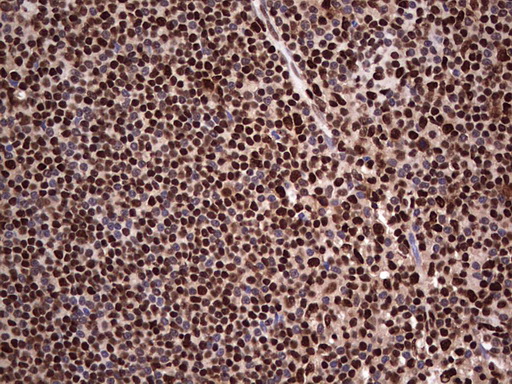 m04753 1 anti sae1 mouse monoclonal antibody clone id oti6b11 ihc testing 16
