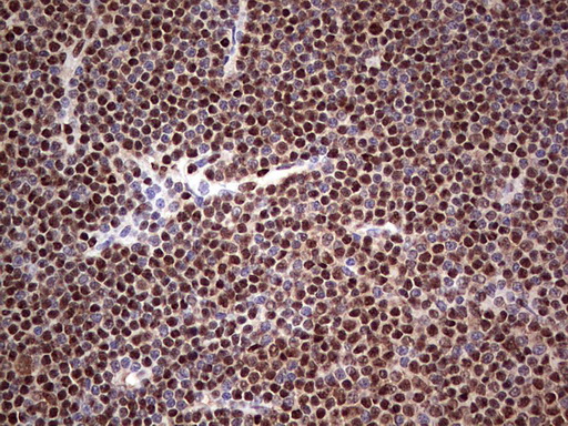 m04753 1 anti sae1 mouse monoclonal antibody clone id oti6b11 ihc testing 17