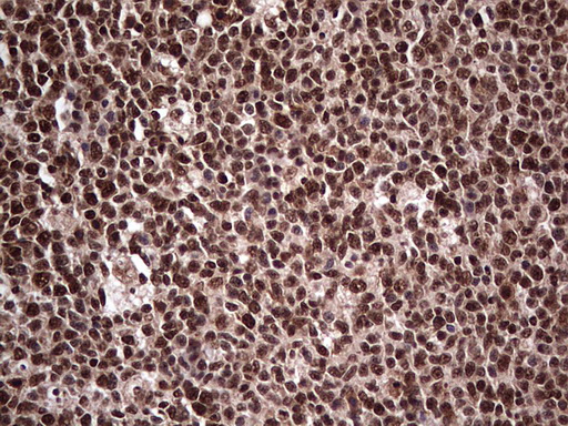 m04753 1 anti sae1 mouse monoclonal antibody clone id oti6b11 ihc testing 18