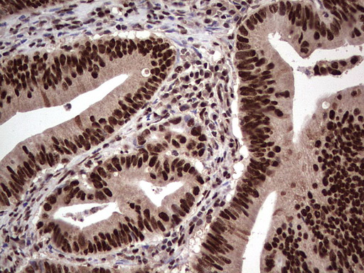 m04753 1 anti sae1 mouse monoclonal antibody clone id oti6b11 ihc testing 19