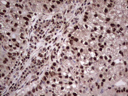 m04753 1 anti sae1 mouse monoclonal antibody clone id oti6b11 ihc testing 2