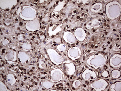 m04753 1 anti sae1 mouse monoclonal antibody clone id oti6b11 ihc testing 20