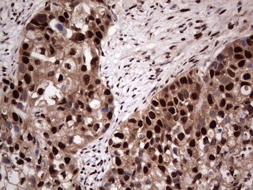 m04753 1 anti sae1 mouse monoclonal antibody clone id oti6b11 ihc testing 21