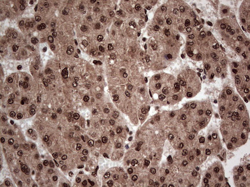 m04753 1 anti sae1 mouse monoclonal antibody clone id oti6b11 ihc testing 22