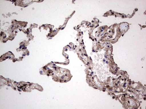 m04753 1 anti sae1 mouse monoclonal antibody clone id oti6b11 ihc testing 23